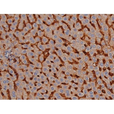 MAPT / Tau Antibody (phospho-Ser422)