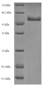 Human ODAM Protein (Recombinant 6His, N-terminus)
