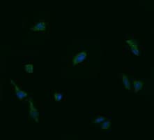 UBE2G2 Antibody (clone OTI1G10)