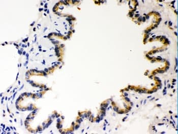 COMT Antibody