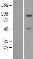 USP45 Protein (Over-Expression Lysate Myc-DDK (Flag))