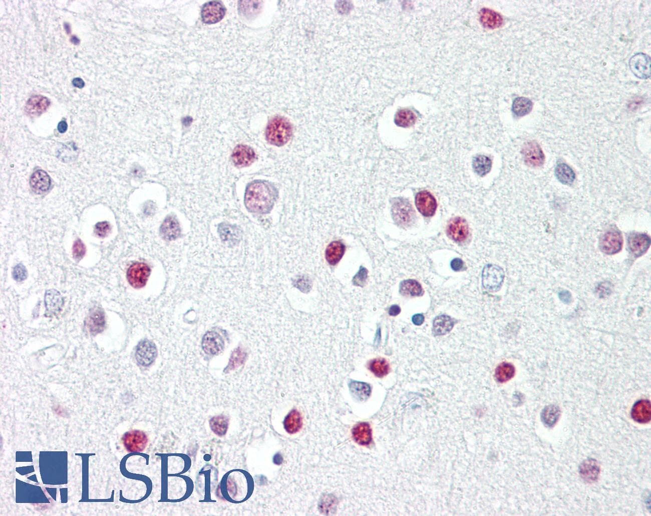 IHC-plus™ GATA4 Antibody (aa330-380)