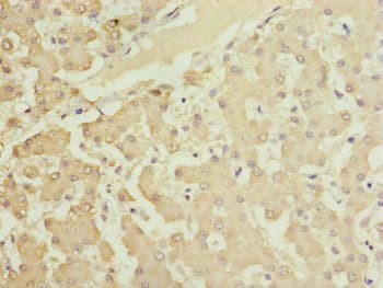 Polyclonal Rabbit anti-Human HOOK2 Antibody (IHC, WB)