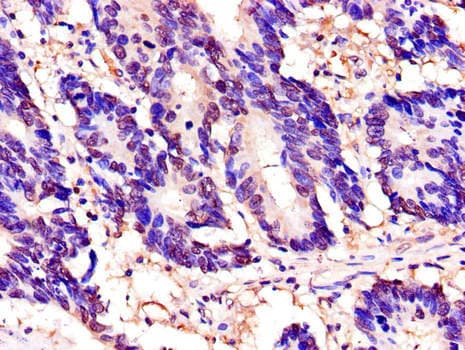TOR1A / Torsin A Antibody