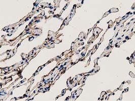 ANXA3 / Annexin A3 Antibody (clone OTI2F3)