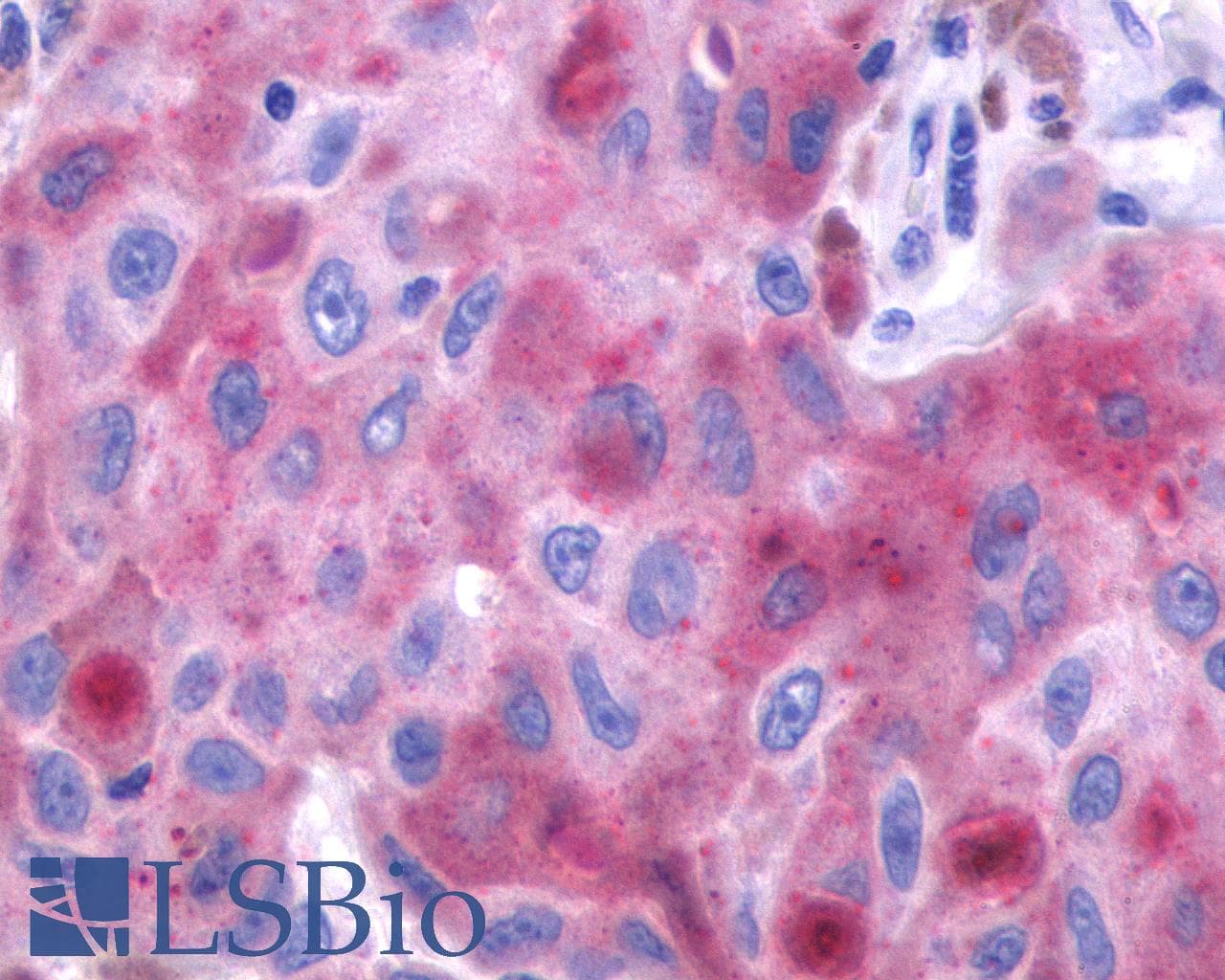 IHC-plus™ FP / PTGFR Antibody (Cytoplasmic Domain)