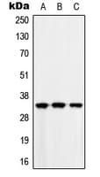 CMT2 / MAD2L1BP Antibody (N-Terminus)