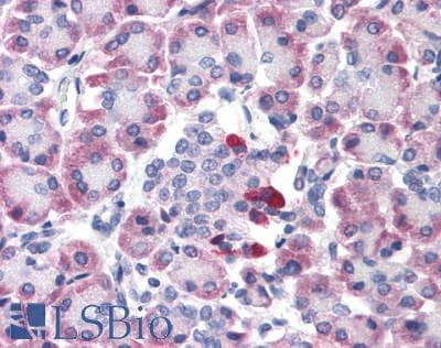 PathPlus™ BRS3 Antibody (C-Terminus)
