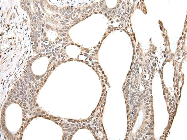 ZBTB5 Antibody