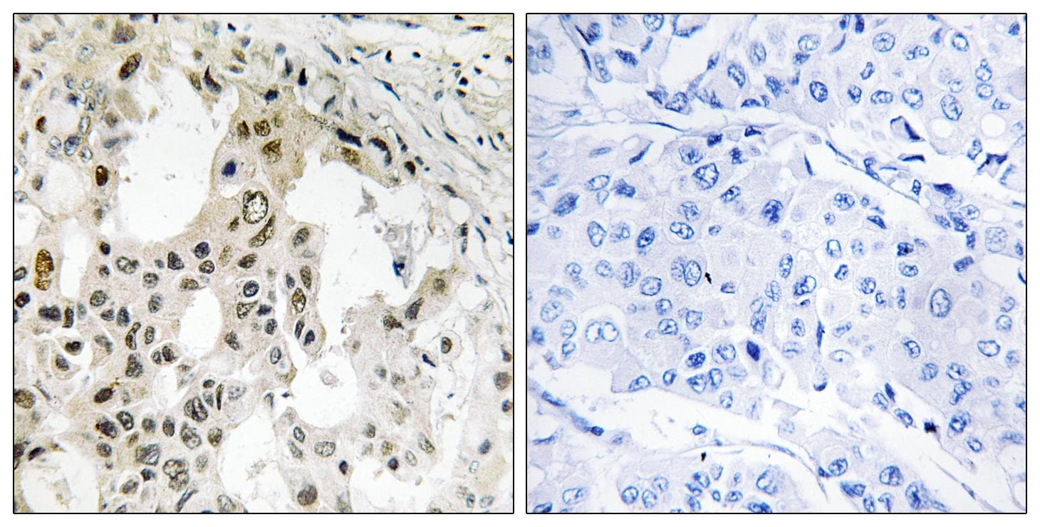 EIF3D Antibody