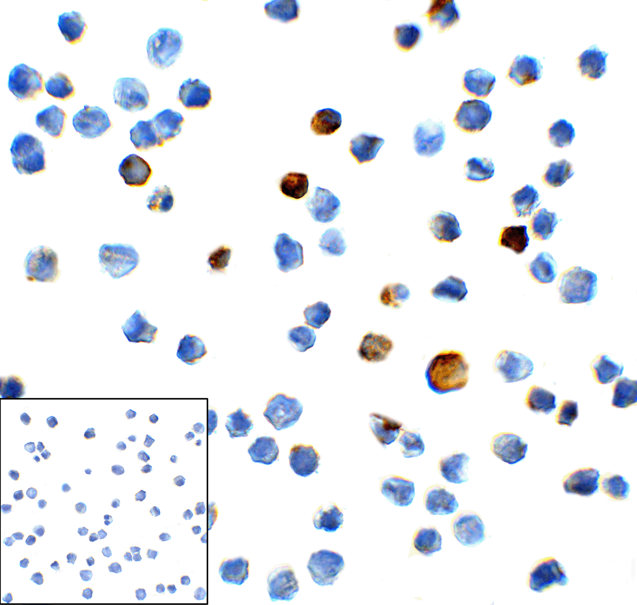 HAVCR2 / TIM-3 Antibody (clone 3G7)