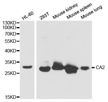 CA2 / Carbonic Anhydrase II Antibody