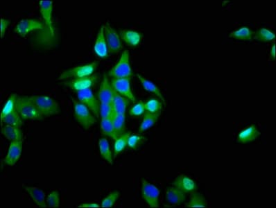 ITGA6/Integrin Alpha 6/CD49f Antibody