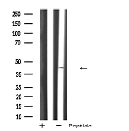 PDHA2 / PDH E1 Beta Antibody
