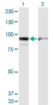 Monoclonal Mouse anti-Human AMPD2 Antibody (clone 6A8, WB)