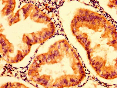 HEXA Antibody