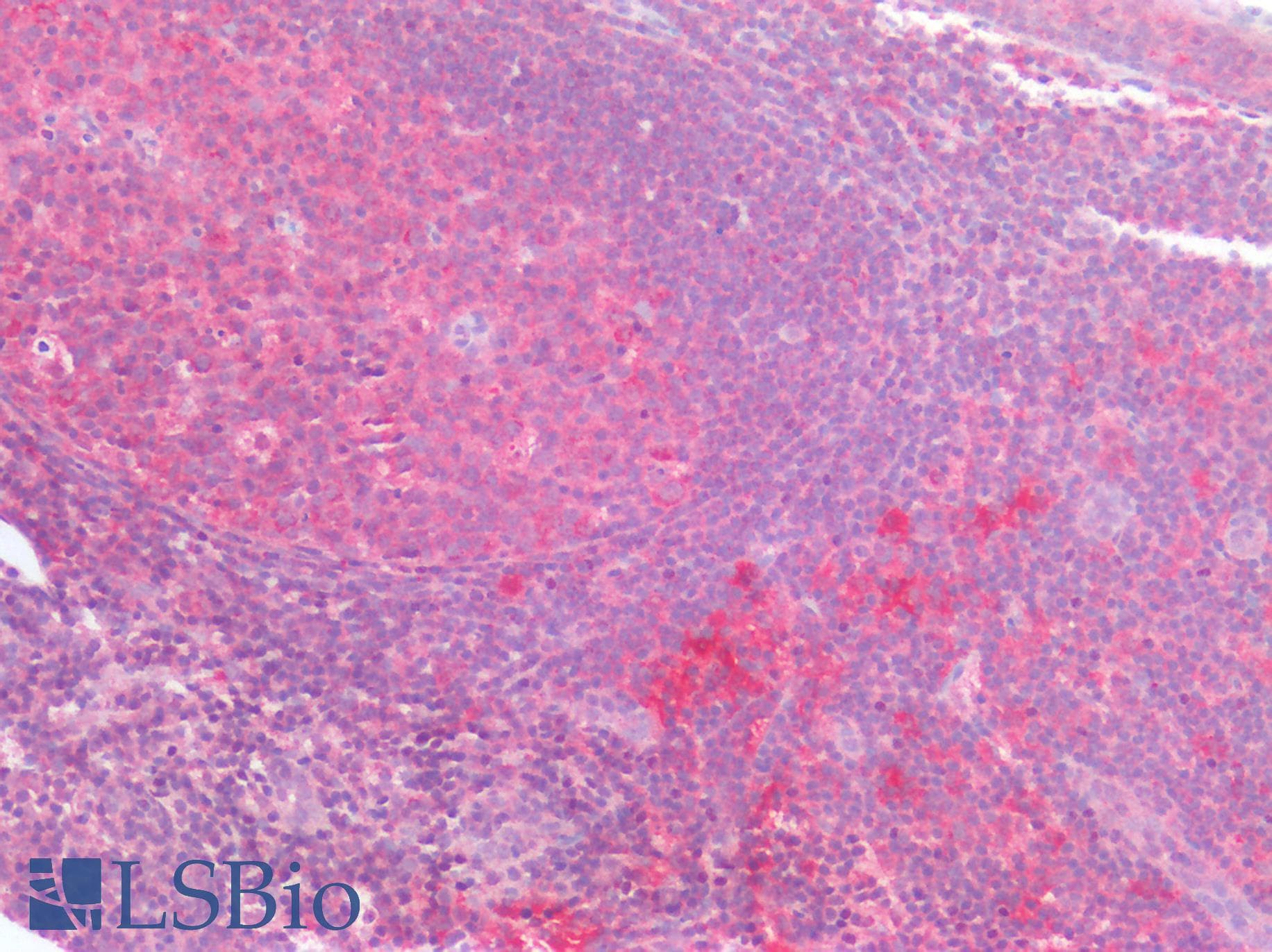 PathPlus™ Polyclonal Rabbit anti-Human GNAQ Antibody (IHC)