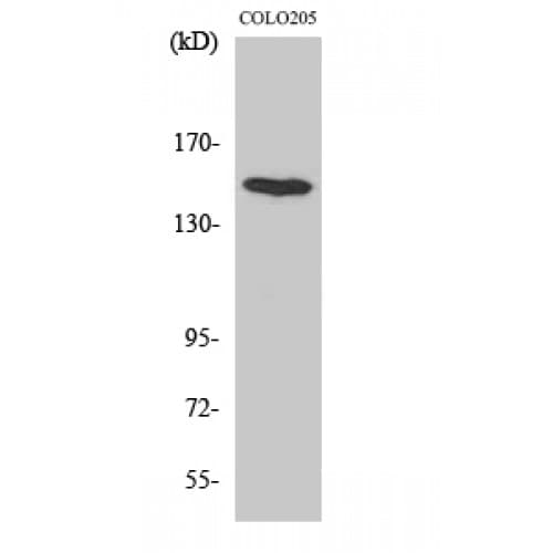 MINK1 / MINK Antibody (370-450 aa, Internal)