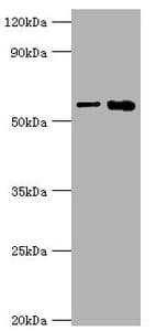 IL1R1 Antibody (aa18-320)