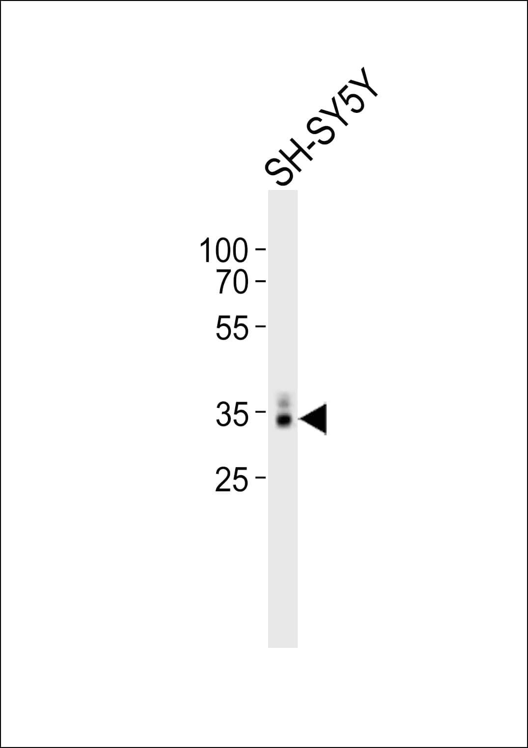 MSI1 / Musashi 1 Antibody (aa144-176)