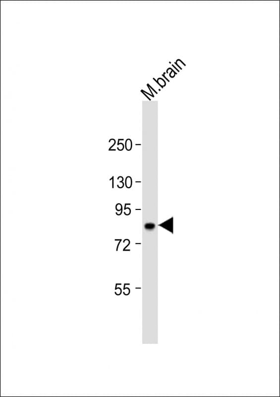 Polyclonal Rabbit anti-Human L3MBTL1 Antibody (aa451-485, WB)