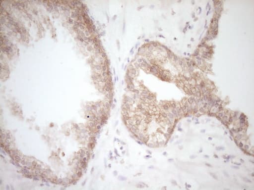 Monoclonal Mouse anti-Human DVL2 / Dishevelled 2 Antibody (clone OTI2E11, aa1-320, IHC, WB)