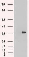 MAPK1 / ERK2 Antibody (clone OTI4D10)