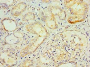 GGA2 Antibody (aa1-300)