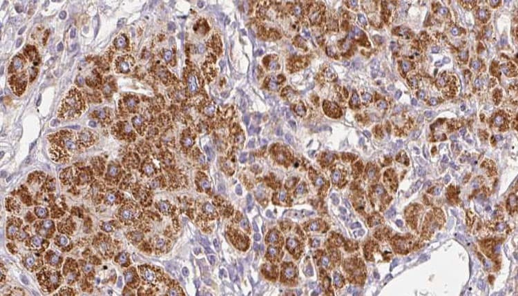 SLC22A6 / OAT1 Antibody