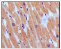NPPB / BNP Antibody (clone 3A6F7C7)