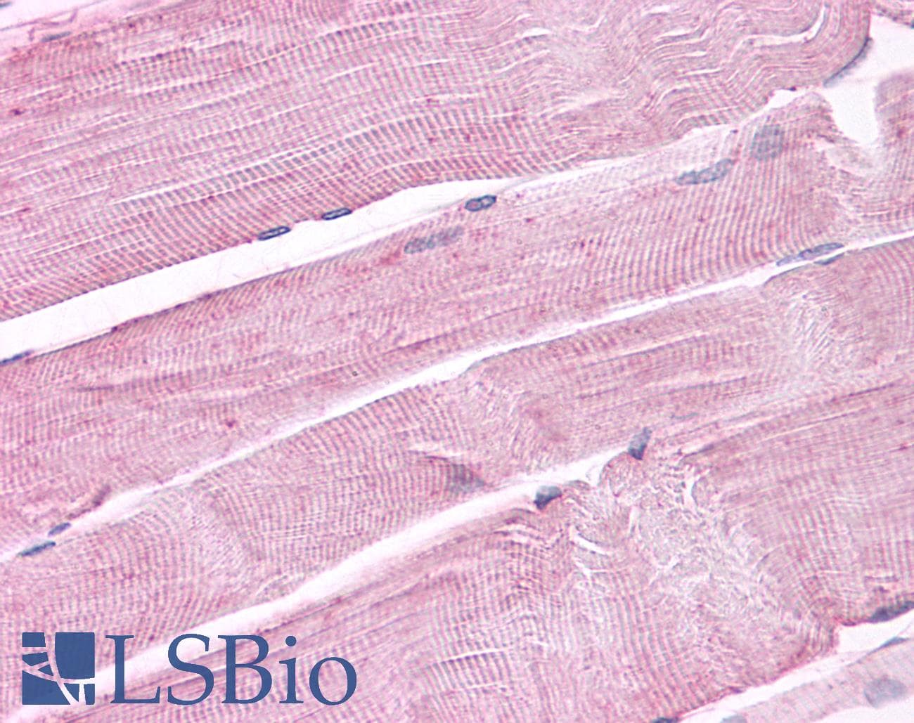 PathPlus™ Polyclonal Rabbit anti-Human PTPRA / RPTP-Alpha Antibody (Cytoplasmic Domain, IHC)