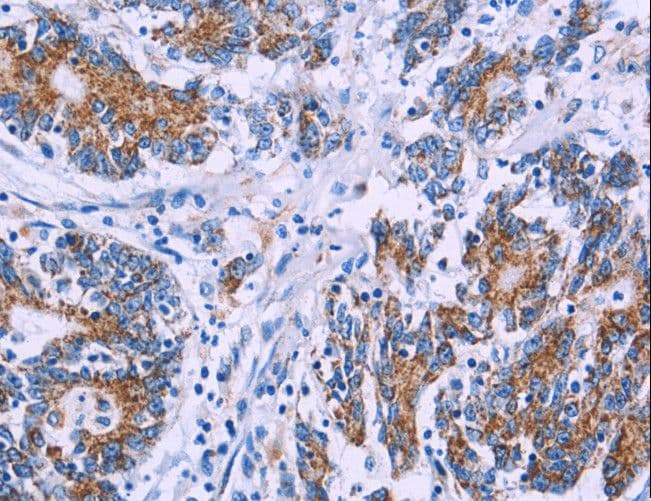 Polyclonal Rabbit anti-Human AGFG1 Antibody (IHC, WB)