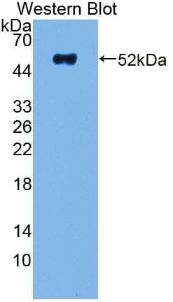 NME5 Antibody (aa3-194)