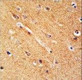 Polyclonal Rabbit anti-Human ANKFY1 Antibody (aa436-465, IHC, WB)