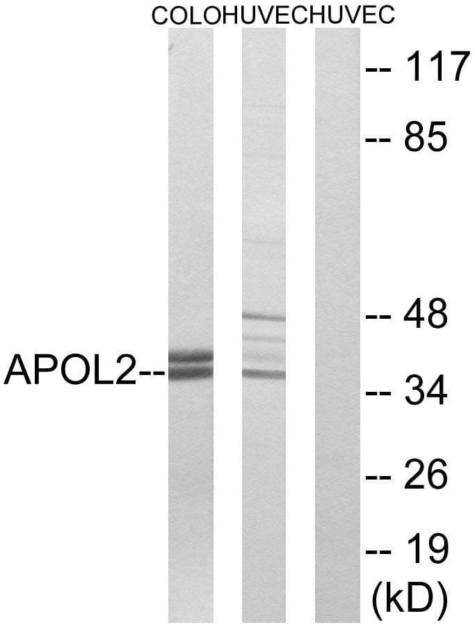 Polyclonal Rabbit anti-Human APOL2 / Apolipoprotein L 2 Antibody (IHC, IF, WB)