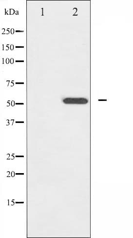 Polyclonal Rabbit anti-Human HNF4A / HNF4 Antibody (phospho-Ser313, IHC, IF, WB)
