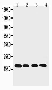 PPIB / Cyclophilin B Antibody (aa176-196)