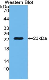 PGLYRP1 / PGRP Antibody (aa22-196)