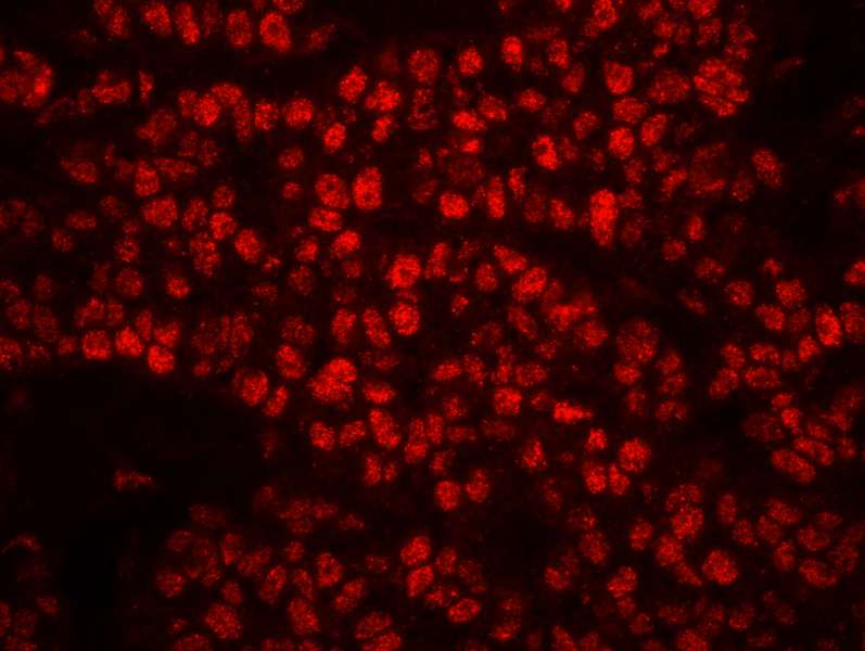 Polyclonal Rabbit anti-Human RPA2 / RFA2 / RPA34 Antibody (phospho-Ser4/8, IHC, IF)