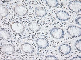 Monoclonal Mouse anti-Human GFAP Antibody (clone OTI5D7, IHC, WB)