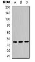 NFKBIE / IKB Epsilon Antibody (phospho-Ser22)