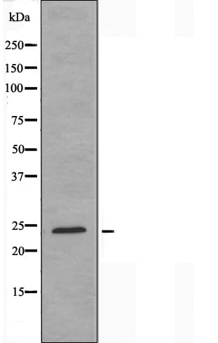 TK1 / TK / Thymidine Kinase Antibody
