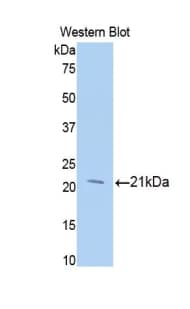 Beta-N-Acetylglucosaminidase Antibody (aa271-438, APC)
