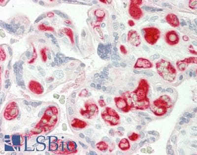 IHC-plus™ Polyclonal Rabbit anti-Human SLC6A8 Antibody (aa581-630, IHC, WB)
