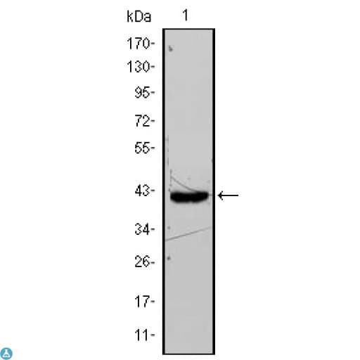 FABP4 / AP2 Antibody