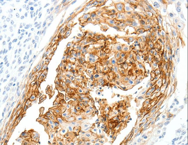 Polyclonal Rabbit anti-Human SEMA3D / Semaphorin 3D Antibody (IHC)