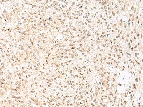 RBX1 / ROC1 Antibody
