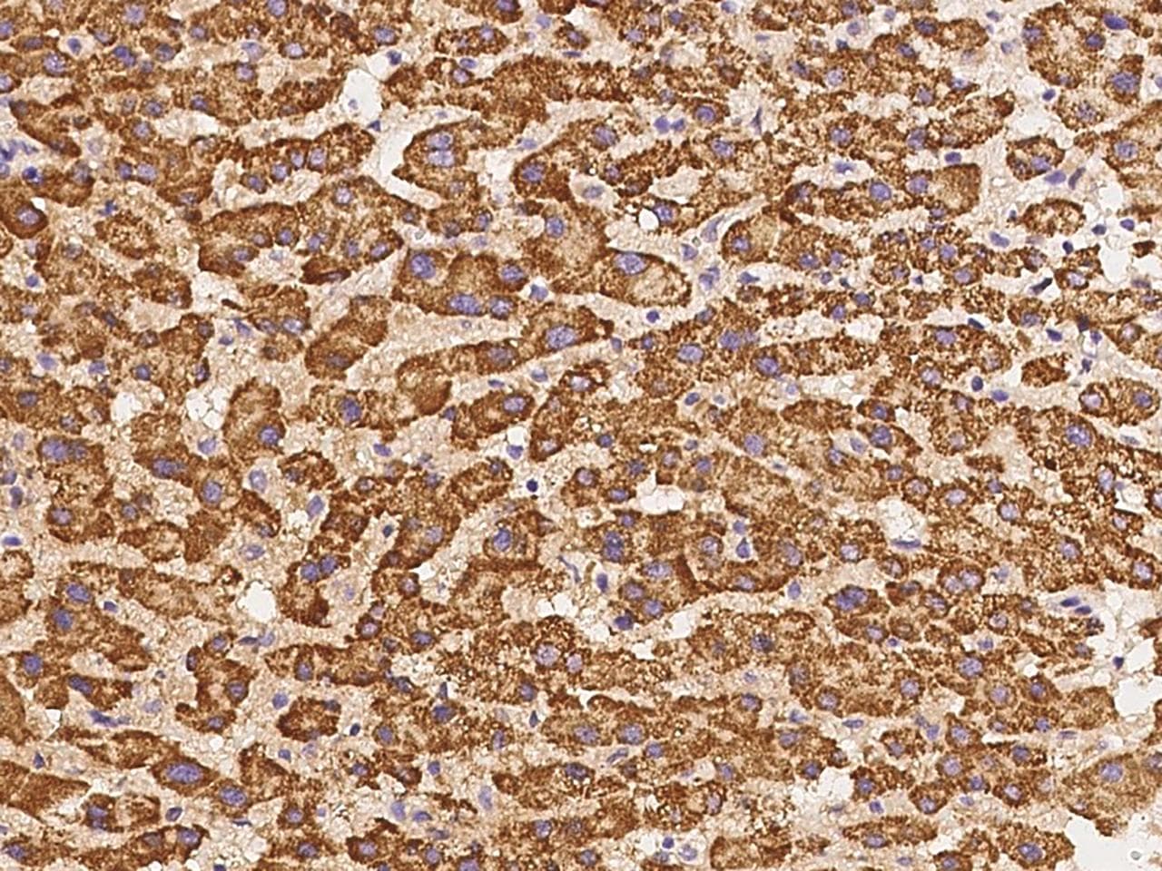 ADRA1D / Adrenoceptor alpha 1D Antibody