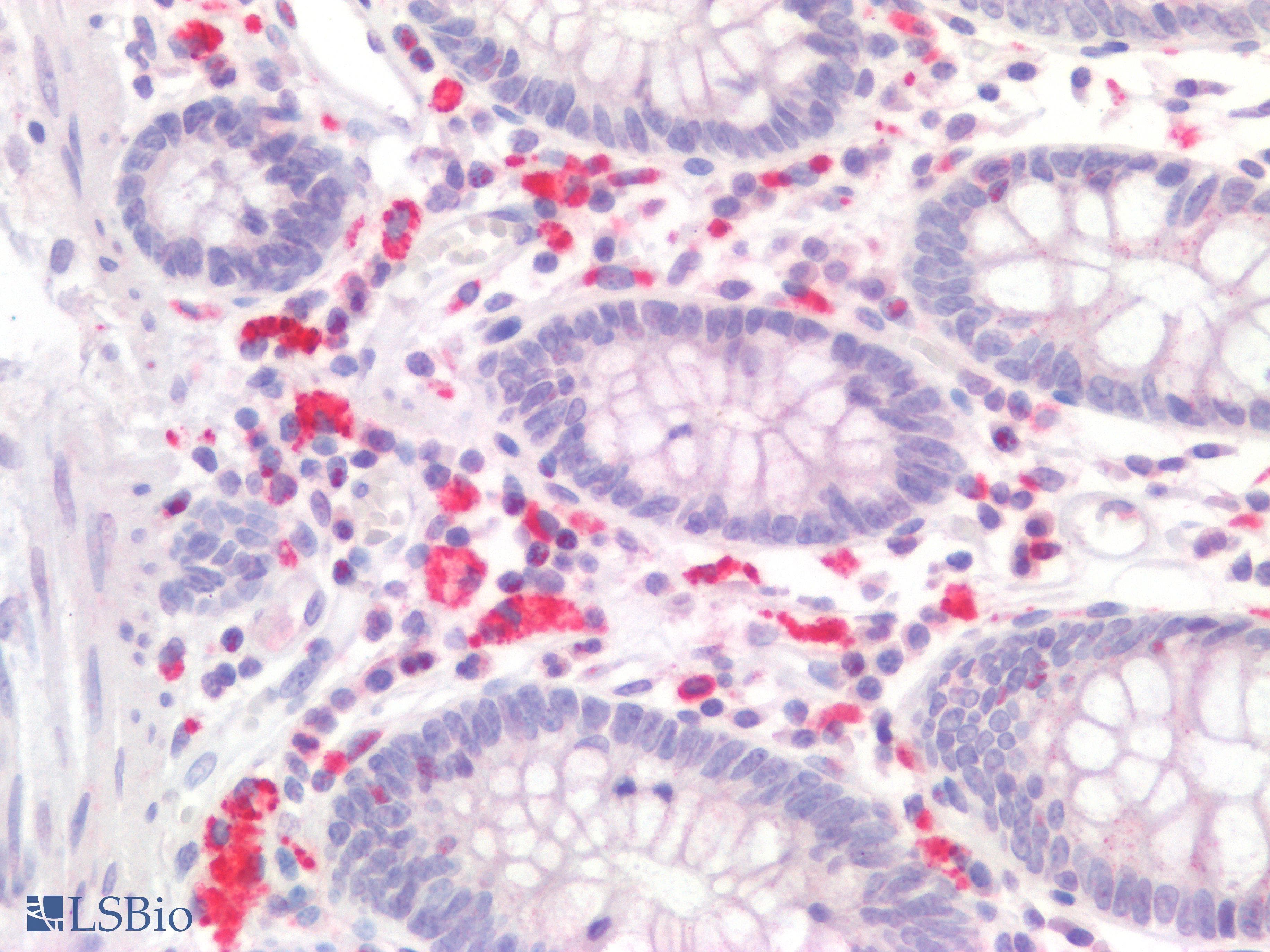 PathPlus™ IL17A Antibody