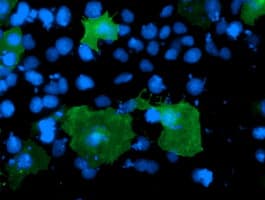 LIMK1 / LIMK Antibody (clone OTI1F1)